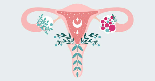 How is PCOS diagnosed and how can you manage it