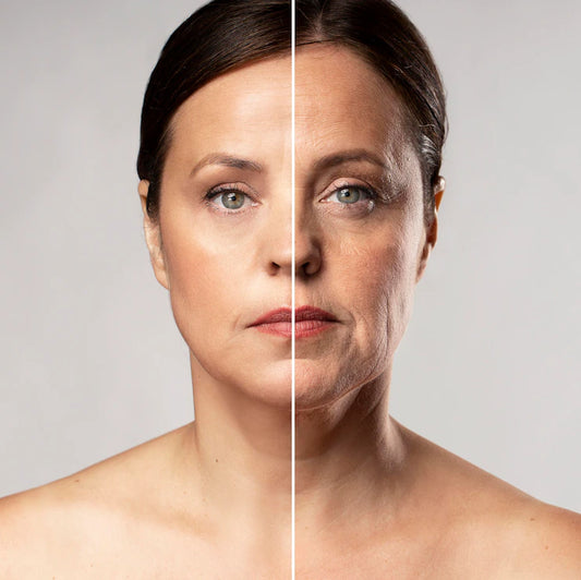 How Can You Reverse Skin-Ageing Naturally