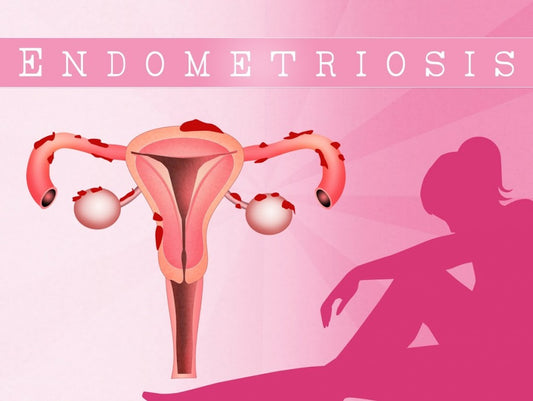 Endometriosis and Fertility: What is the connection?