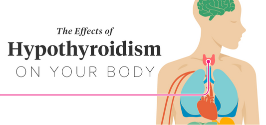 What is hypothyroidism?